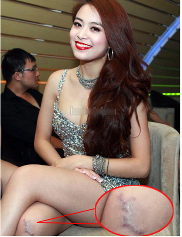 kem-tri-seo-white-doctors-scar-clearr-1