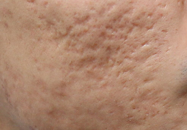 kem-tri-seo-white-doctors-scar-clearr-2