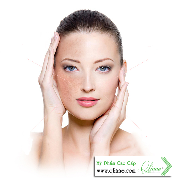 kem-tri-tan-nhang-tan-goc-1