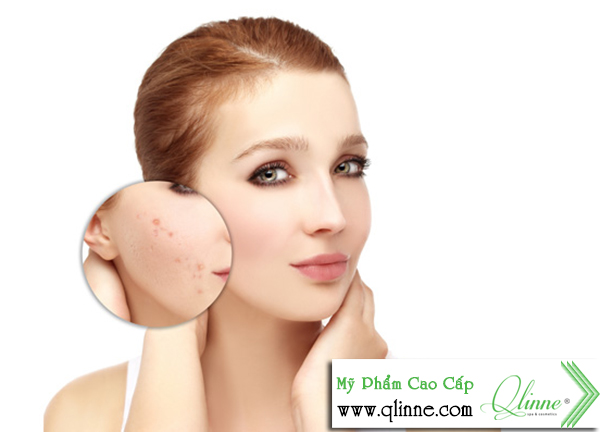 nguyen-tac-su-dung-kem-tri-nam-3