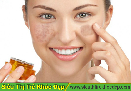 tim-hieu-ve-kem-tri-nam-da-1