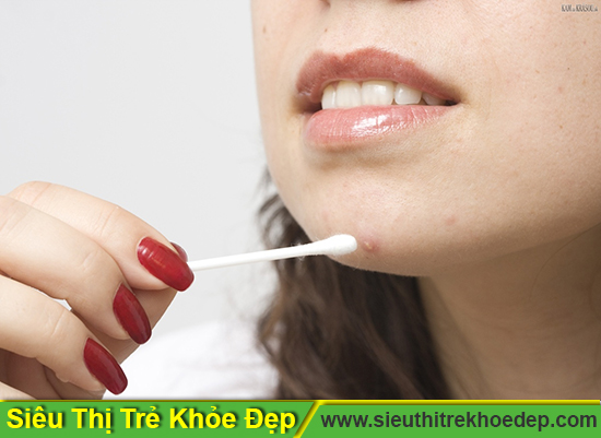 tri-mun-boc-tan-goc-1